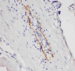 Invitrogen P-Selectin (CD62P) Polyclonal Antibody 100 &mu;g | Buy Online | Invitrogen&trade; | Fisher Scientific