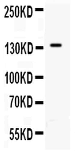Invitrogen P-Selectin (CD62P) Polyclonal Antibody 100 &mu;g | Buy Online | Invitrogen&trade; | Fisher Scientific