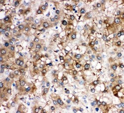 Invitrogen SERPINA6 Polyclonal Antibody 100 &mu;g | Buy Online | Invitrogen&trade; | Fisher Scientific