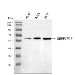 Invitrogen SERPINA6 Polyclonal Antibody 100 &mu;g | Buy Online | Invitrogen&trade; | Fisher Scientific