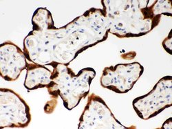 Invitrogen SERPINB2 Polyclonal Antibody 100 &mu;g; Unconjugated:Antibodies,