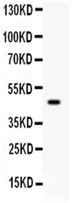 Invitrogen SERPINB2 Polyclonal Antibody 100 &mu;g; Unconjugated:Antibodies,