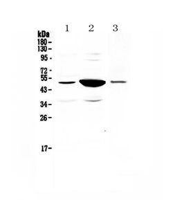 PAI1 Polyclonal Antibody:Antibodies, Polyclonal