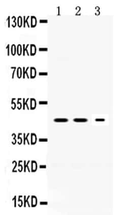 Invitrogen Neuroserpin Polyclonal Antibody 100 &mu;g | Buy Online | Invitrogen&trade; | Fisher Scientific