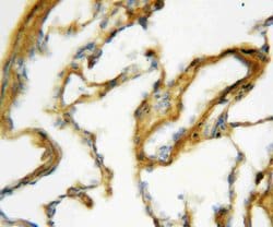 Invitrogen SFTPA1 Polyclonal Antibody 100 &mu;g; Unconjugated:Antibodies,