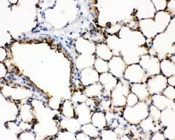 Invitrogen SFTPA1 Polyclonal Antibody 100 &mu;g; Unconjugated:Antibodies,