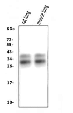 Invitrogen SFTPA1 Polyclonal Antibody 100 &mu;g; Unconjugated:Antibodies,