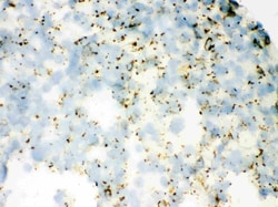 Invitrogen SFTPA1/SFTPA2 Polyclonal Antibody 100 &mu;g; Unconjugated:Antibodies,