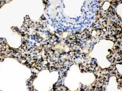 Invitrogen SFTPA1/SFTPA2 Polyclonal Antibody 100 &mu;g; Unconjugated:Antibodies,