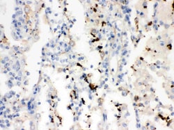 Invitrogen SFTPA1/SFTPA2 Polyclonal Antibody 100 &mu;g; Unconjugated:Antibodies,