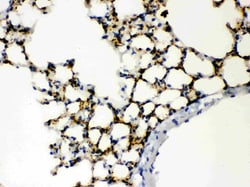 Invitrogen SFTPA1/SFTPA2 Polyclonal Antibody 100 &mu;g; Unconjugated:Antibodies,