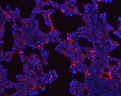 Invitrogen SFTPA1/SFTPA2 Polyclonal Antibody 100 &mu;g; Unconjugated:Antibodies,