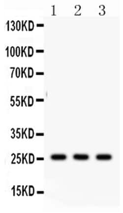 Invitrogen SFTPA1/SFTPA2 Polyclonal Antibody 100 &mu;g; Unconjugated:Antibodies,