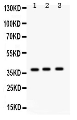 Invitrogen SFTPD Polyclonal Antibody 100 &mu;g; Unconjugated:Antibodies,