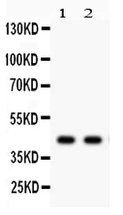 Alpha Sarcoglycan Polyclonal Antibody:Antibodies, Polyclonal