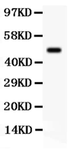 Invitrogen SGK1 Polyclonal Antibody 100 &mu;g; Unconjugated:Antibodies,
