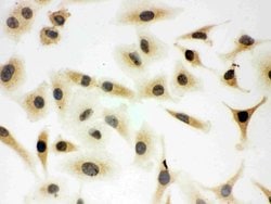 SHC Polyclonal Antibody:Antibodies, Polyclonal