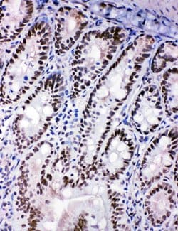 SHC Polyclonal Antibody:Antibodies, Polyclonal