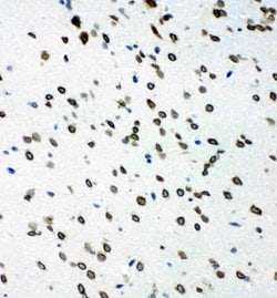 SHC Polyclonal Antibody:Antibodies, Polyclonal