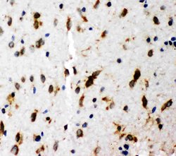 SHC Polyclonal Antibody:Antibodies, Polyclonal