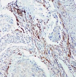 SHC Polyclonal Antibody:Antibodies, Polyclonal