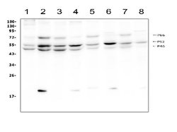 SHC Polyclonal Antibody:Antibodies, Polyclonal