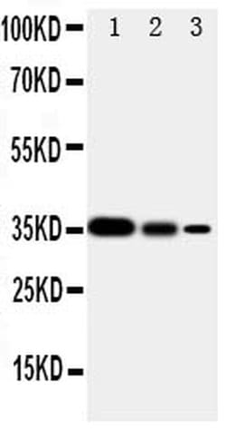 SHC Polyclonal Antibody:Antibodies, Polyclonal