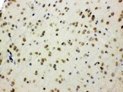 Invitrogen SHC Polyclonal Antibody 100 &mu;g; Unconjugated:Antibodies,