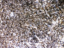 Invitrogen SIRT7 Polyclonal Antibody 100 &mu;g; Unconjugated:Antibodies,