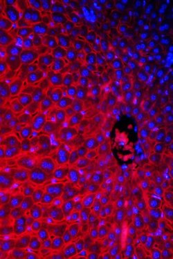NTCP Polyclonal Antibody:Antibodies, Polyclonal