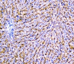 NTCP Polyclonal Antibody:Antibodies, Polyclonal