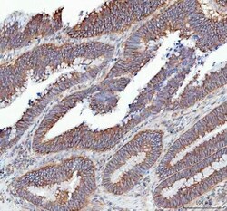 Invitrogen SLC12A6 Polyclonal Antibody 100 &mu;g; Unconjugated:Antibodies,