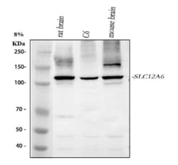 Invitrogen SLC12A6 Polyclonal Antibody 100 &mu;g; Unconjugated:Antibodies,
