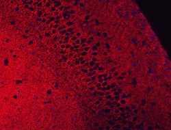 Invitrogen GLT-1 Polyclonal Antibody 100 &mu;g | Buy Online | Invitrogen&trade; | Fisher Scientific