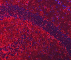 Invitrogen&trade;&nbsp;GLT-1 Polyclonal Antibody
