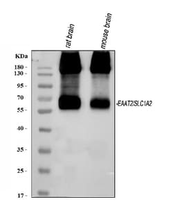 Invitrogen GLT-1 Polyclonal Antibody 100 &mu;g | Buy Online | Invitrogen&trade; | Fisher Scientific