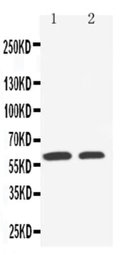 SLC22A1 Polyclonal Antibody:Antibodies, Polyclonal