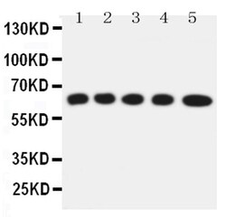 Invitrogen SLC22A5 Polyclonal Antibody 100 &mu;g; Unconjugated:Antibodies,