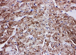 Invitrogen GLUT4 Polyclonal Antibody 100 &mu;g; Unconjugated:Antibodies,