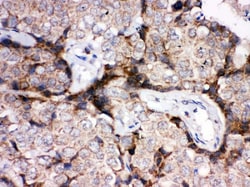 Invitrogen GLUT4 Polyclonal Antibody 100 &mu;g; Unconjugated:Antibodies,