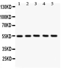Invitrogen GLUT4 Polyclonal Antibody 100 &mu;g; Unconjugated:Antibodies,