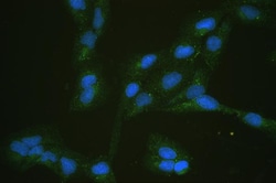 Invitrogen GLUT5 Polyclonal Antibody 100 &mu;g | Buy Online | Invitrogen&trade; | Fisher Scientific