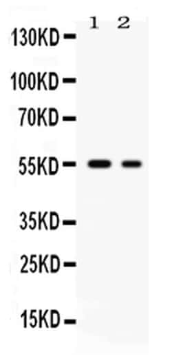 Invitrogen GLUT5 Polyclonal Antibody 100 &mu;g | Buy Online | Invitrogen&trade; | Fisher Scientific