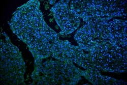 Invitrogen GLUT9 Polyclonal Antibody 100 &mu;g; Unconjugated:Antibodies,