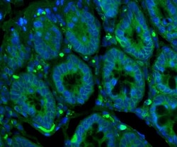Invitrogen GLUT9 Polyclonal Antibody 100 &mu;g; Unconjugated:Antibodies,