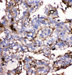 Invitrogen GLUT9 Polyclonal Antibody 100 &mu;g; Unconjugated:Antibodies,
