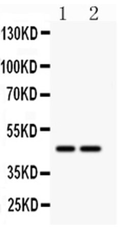SLC30A4 Polyclonal Antibody, Invitrogen 100 &mu;g; Unconjugated:Antibodies,