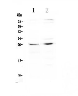 CTR1 Polyclonal Antibody:Antibodies, Polyclonal