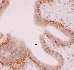 Invitrogen Nhe-1 Polyclonal Antibody 100 &mu;g; Unconjugated:Antibodies,