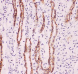 Invitrogen Nhe-1 Polyclonal Antibody 100 &mu;g; Unconjugated:Antibodies,